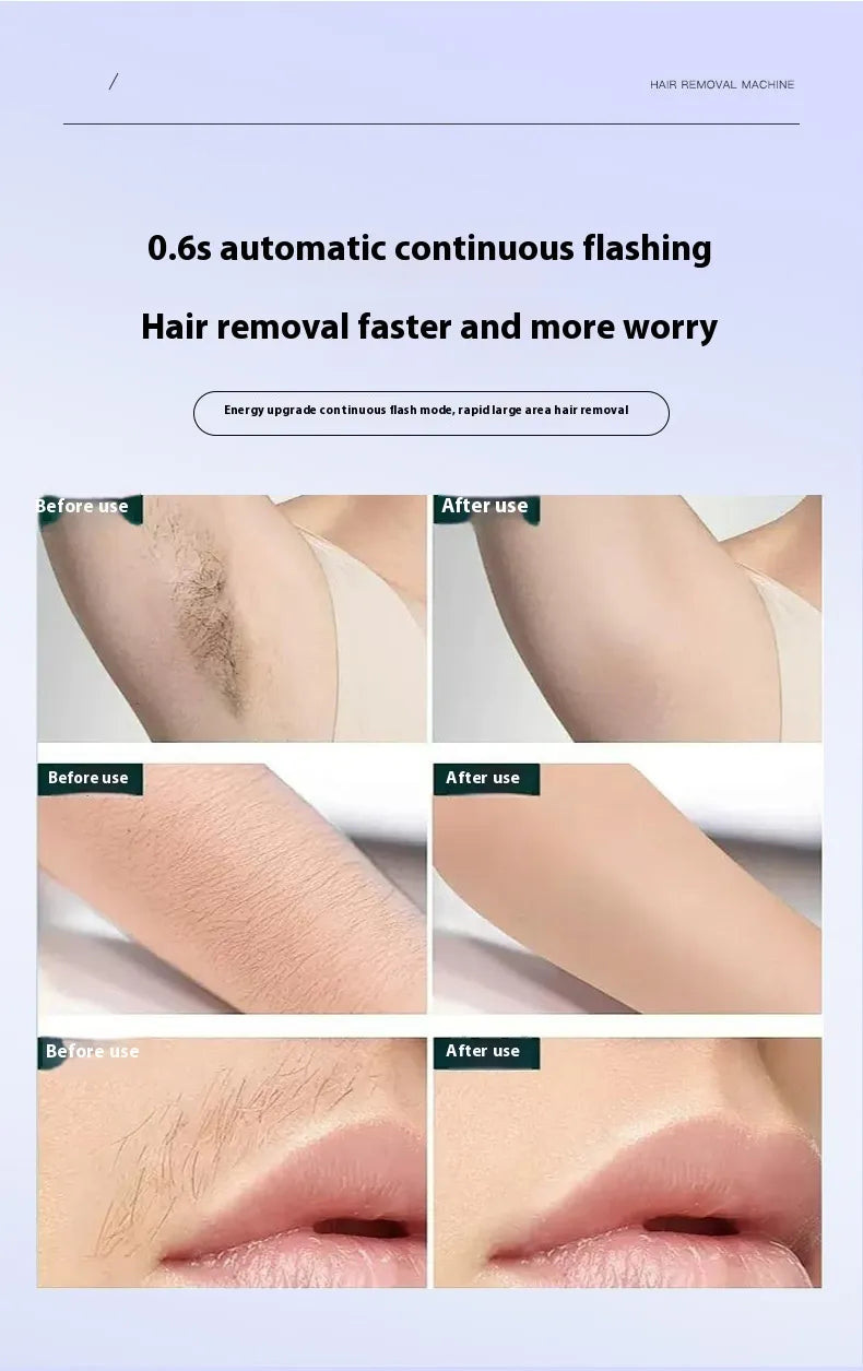 Painless IPL Hair Removal Device