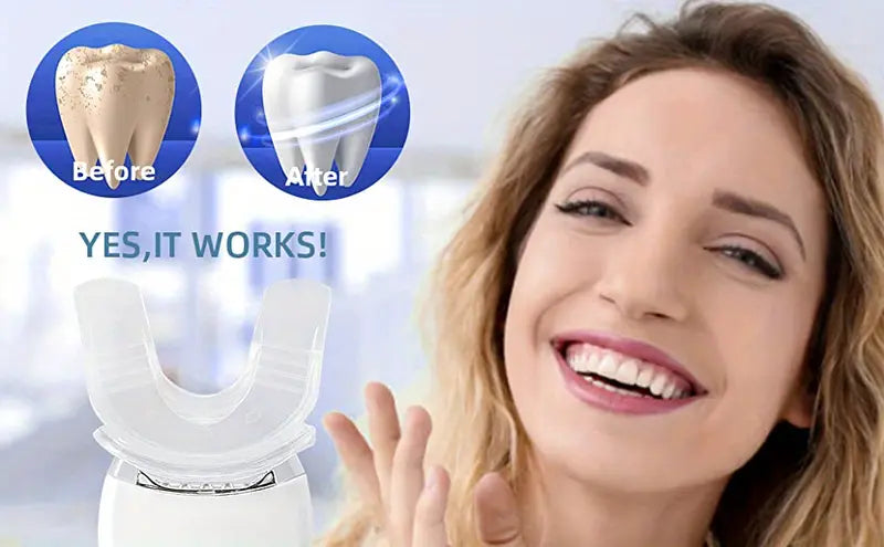 LED Teeth Whitening Kit with Gel and Light