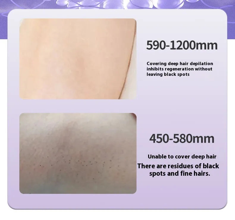 Painless IPL Hair Removal Device