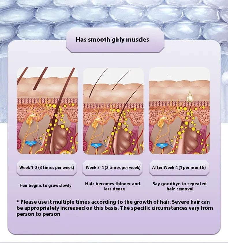 Painless IPL Hair Removal Device